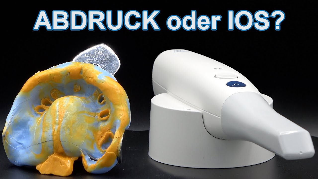IO Scanner | gekommen um zu bleiben