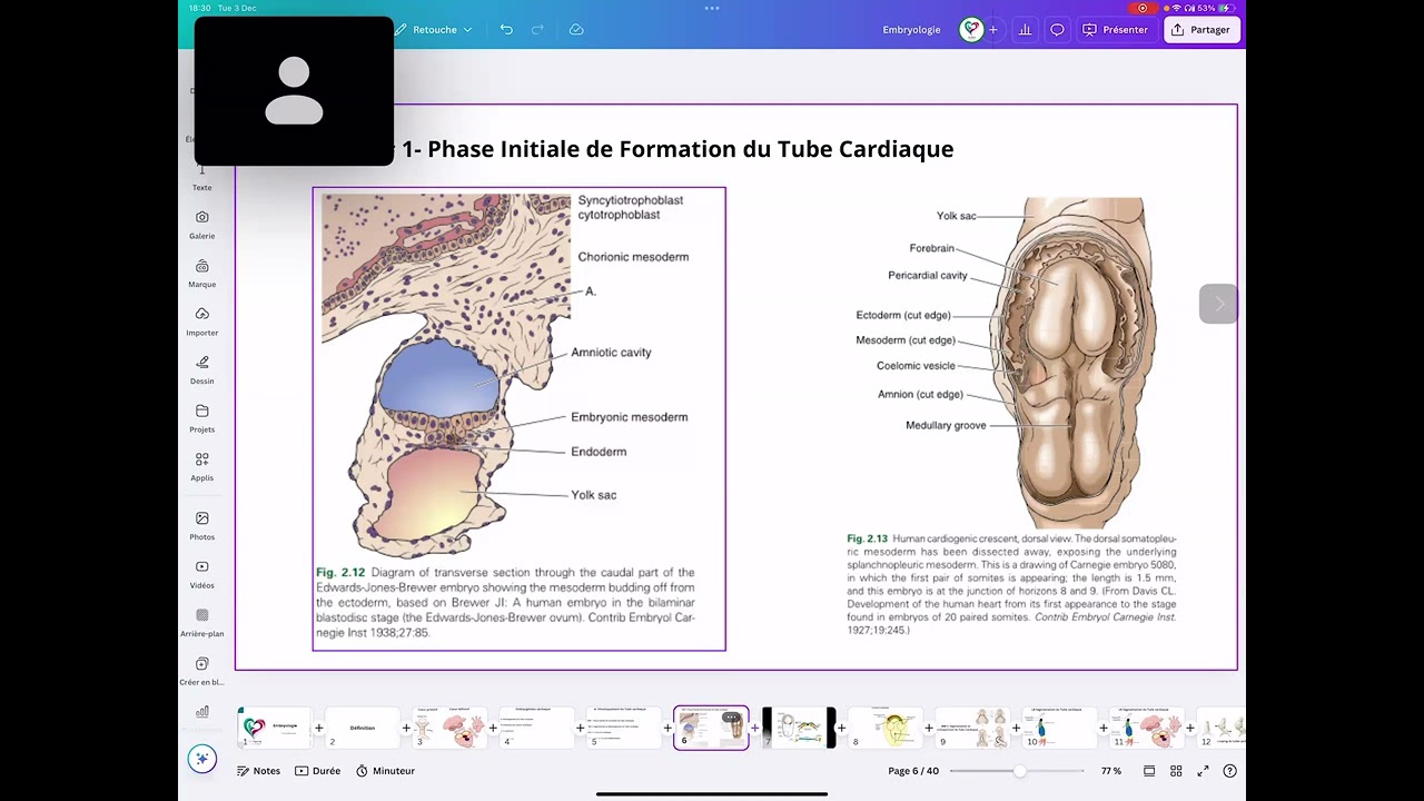 CSC-Formation congénitale : Embryologie