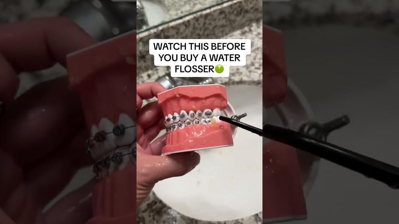 Top Dentist Reveals Shocking Water Flosser Secrets
