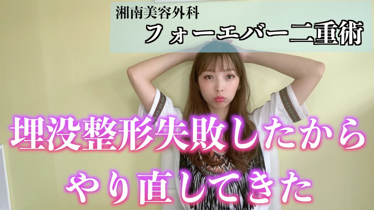 【二重整形】幅が広くなりすぎたから埋没やり直してきた【湘南美容外科/フォーエバー二重術】