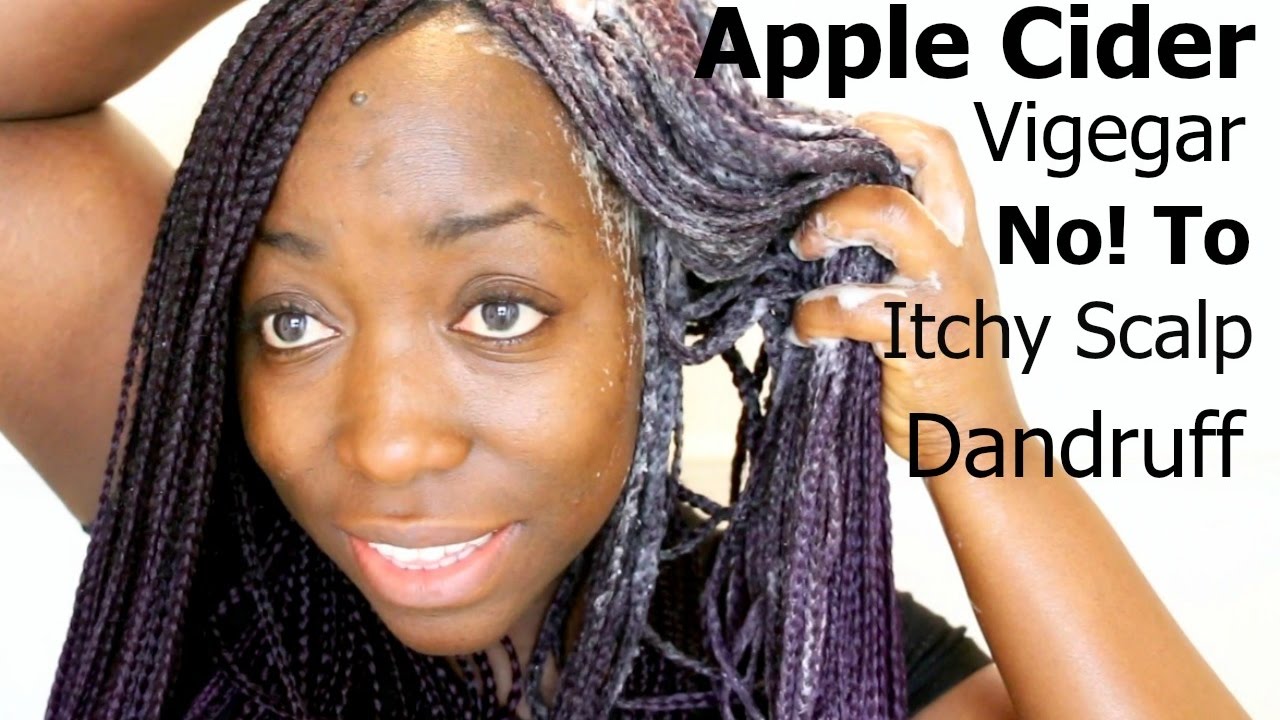 Box Braids Wash Day Apple Cider Vinegar Rinse lift Dirt Buildups Natural Hair Dandruff Itchy Scalp
