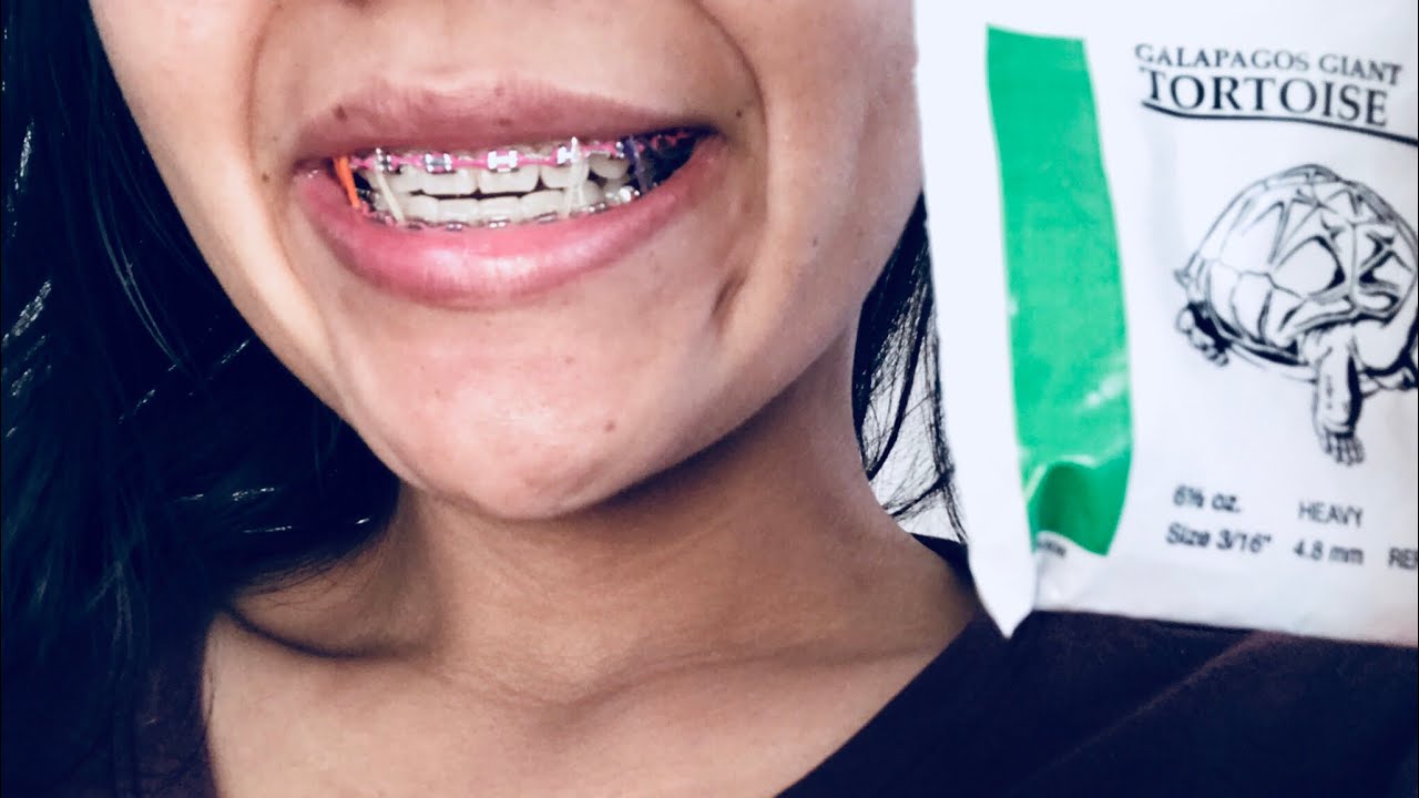 ASMR: ❤️👄👅TONGUE PLAY💋👂🤭(BRACE FACE EDITION)Tingling Tapping Mouth Metal, Rubber Bands Popping