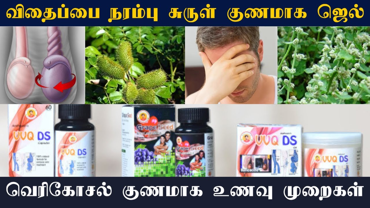 விதைப்பை நரம்பு சுருள் குணமாக ஜெல் பயன்படுத்தலாமா? | வெரிகோசல் குணமாக உணவு முறைகள் #testicularpain