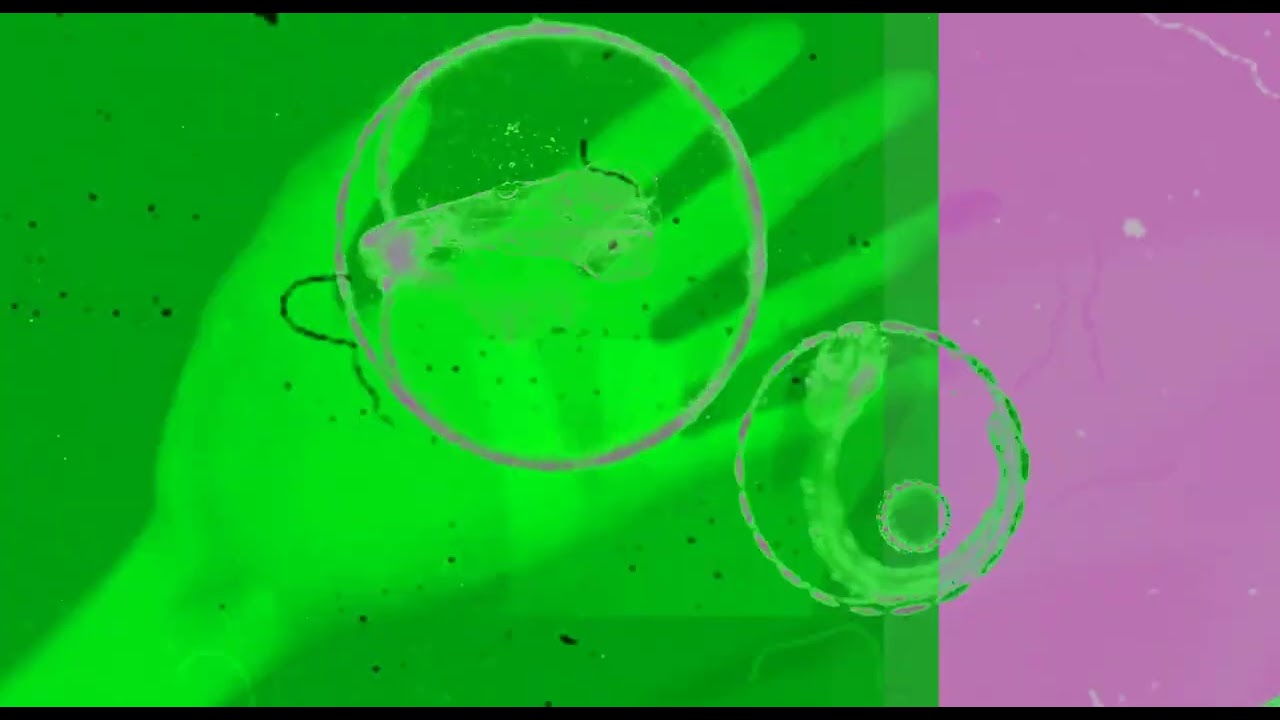Acid Spirit X Bipolar Disorder - Track X Vaer Underfull