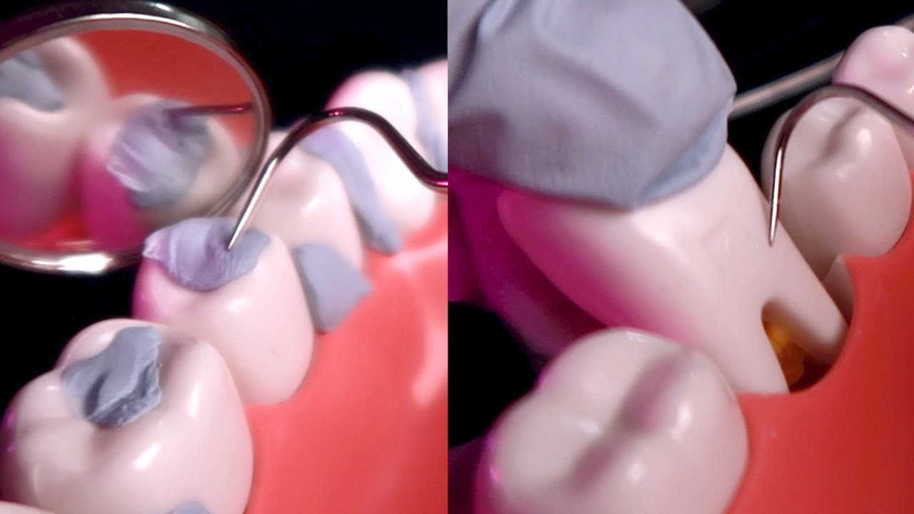 ASMR🦷 1 час удаления зубного камня ⎢ Глубокая чистка зубов ⎢ Зубной инструмент (без разговоров)