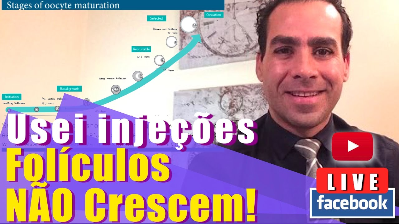 🔴AO-VIVO - Muitas Injeções e poucos folículos?! Pode ser pelo medicamento?