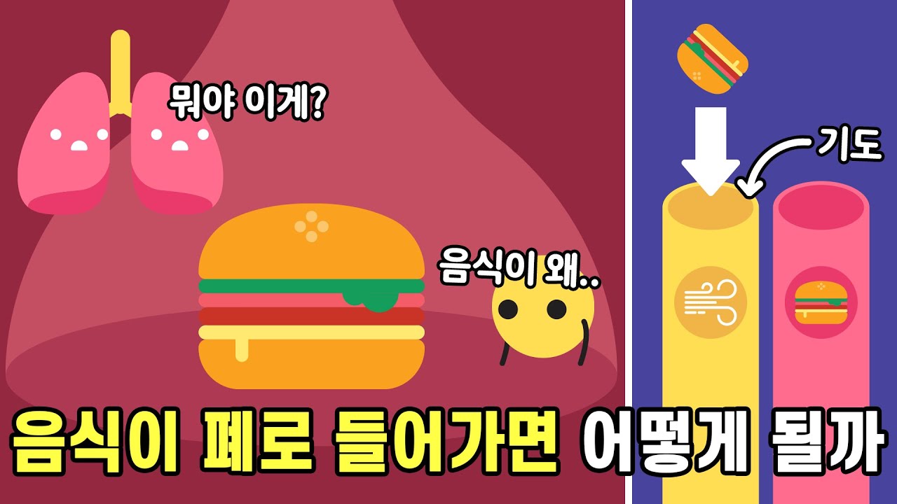 음식이 위가 아니라 폐로 가면 어떤 일이 일어날까