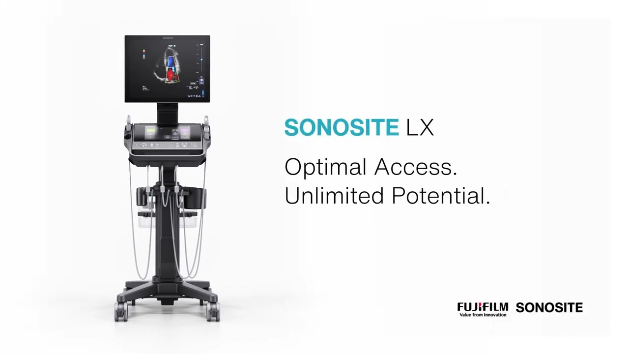 SONOSITE LX: Optimal Access. Unlimited Potential.