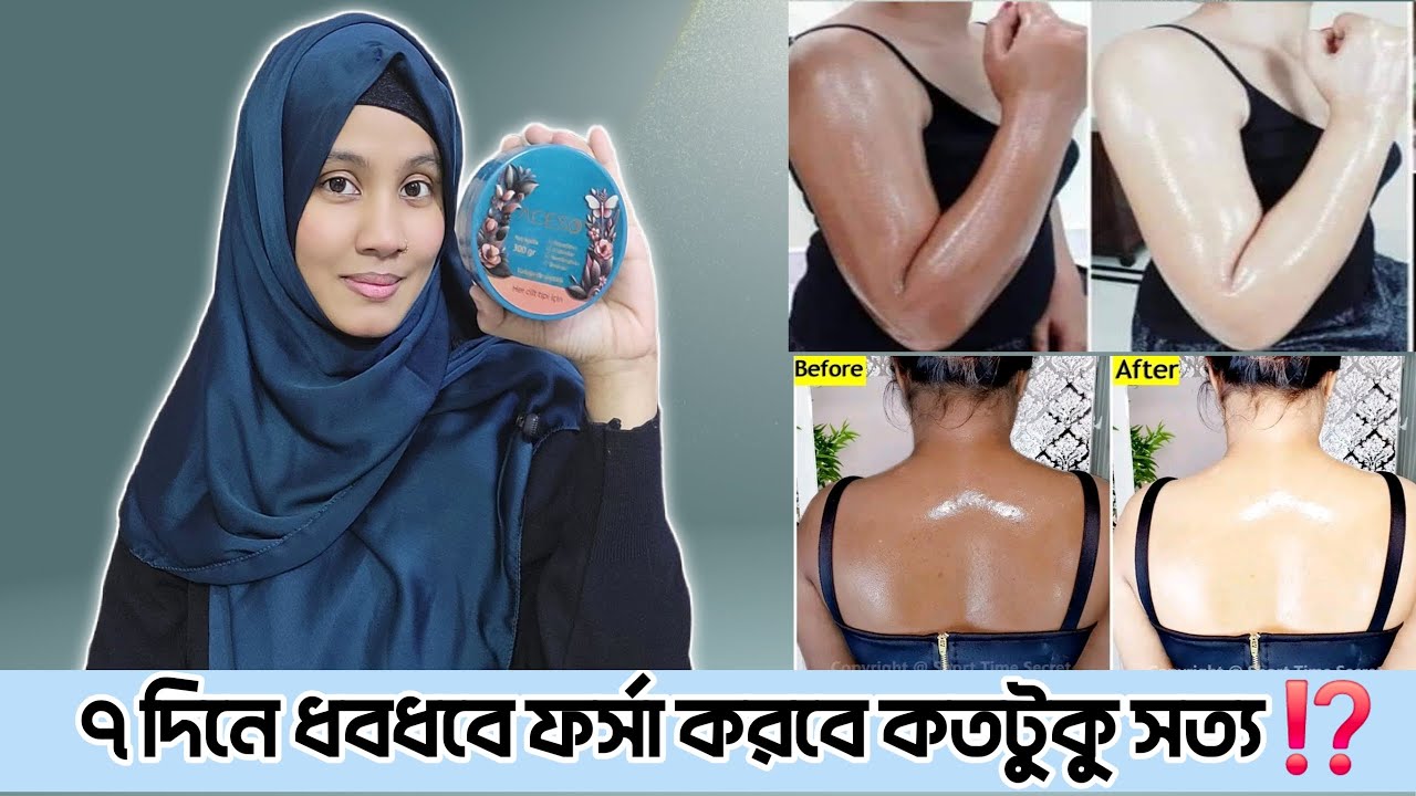 Aceso Body Whitening Cream | Aceso body whitening cream review|Body Whitening Cream|Moriom Akter Mim