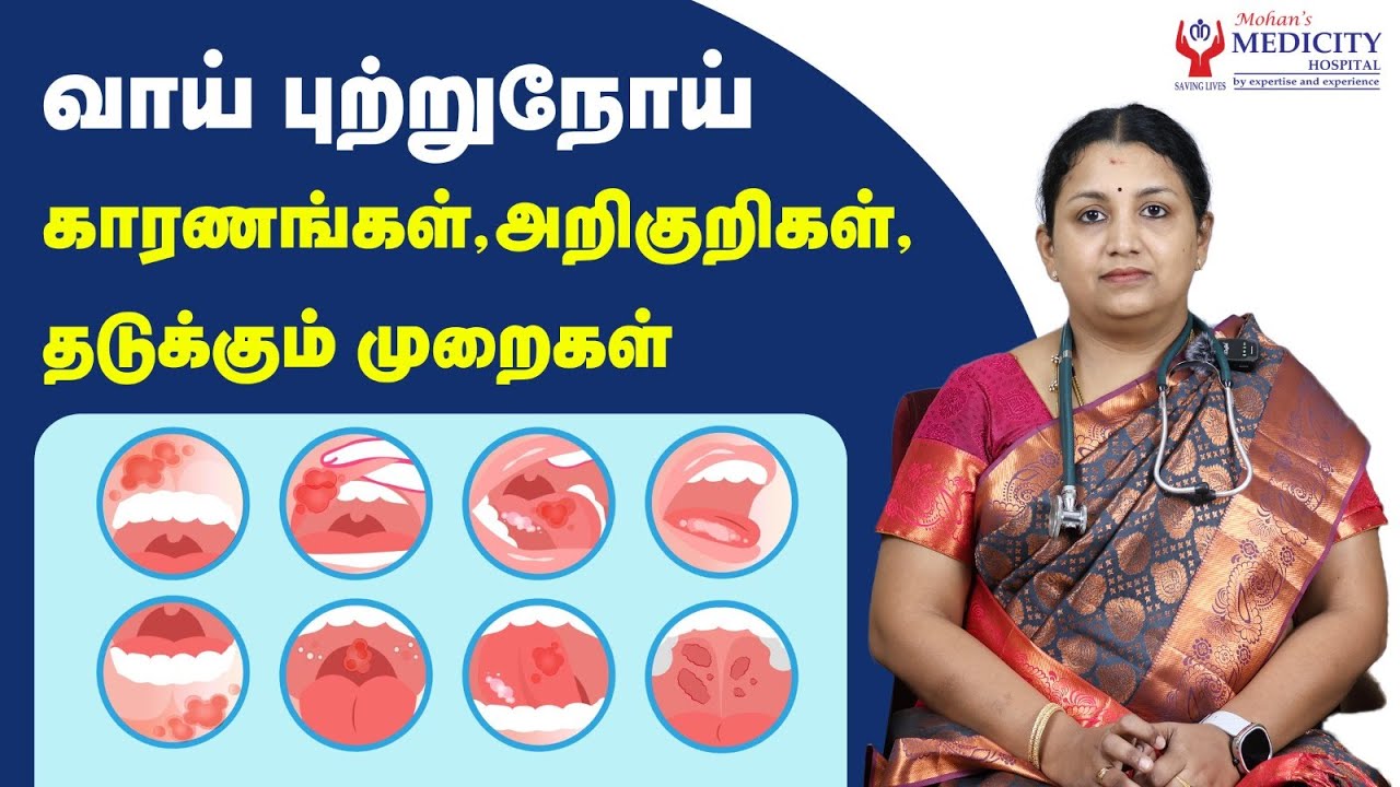 வாய் புற்றுநோய் காரணங்கள், அறிகுறிகள்,தடுக்கும் முறைகள் | Oral Cancer