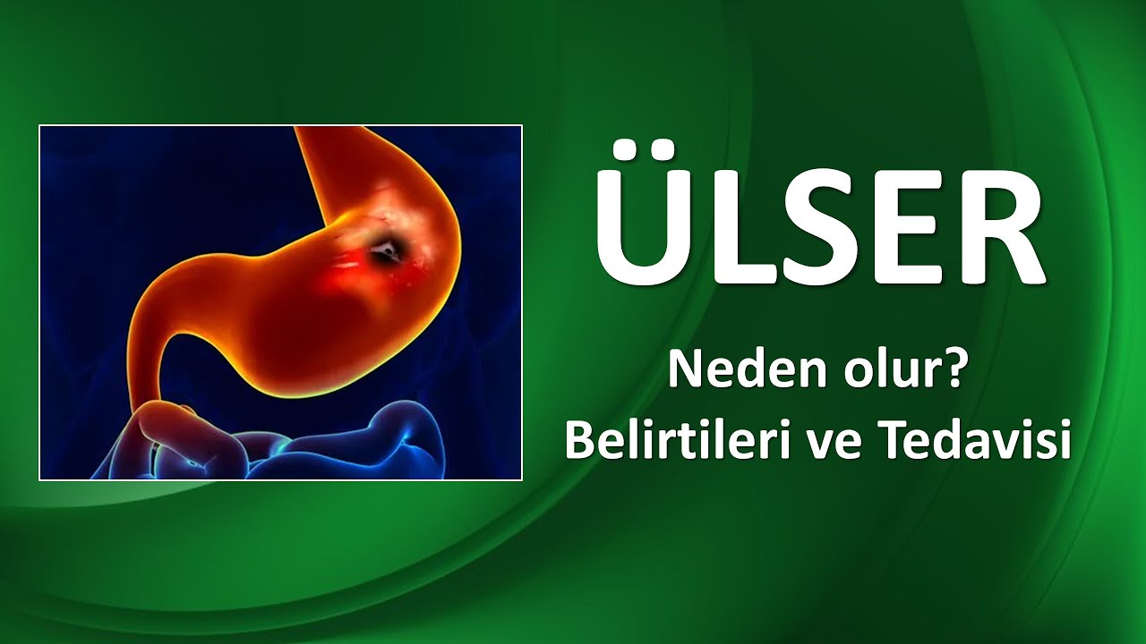 ÜLSER NEDİR? NASIL TEDAVİ EDİLİR?