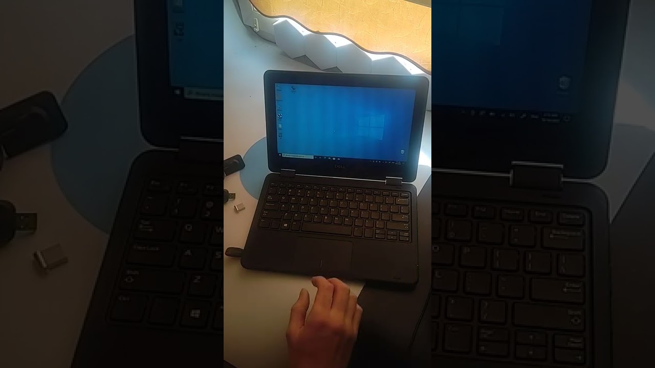 Настройка візіографа Dental sensor
