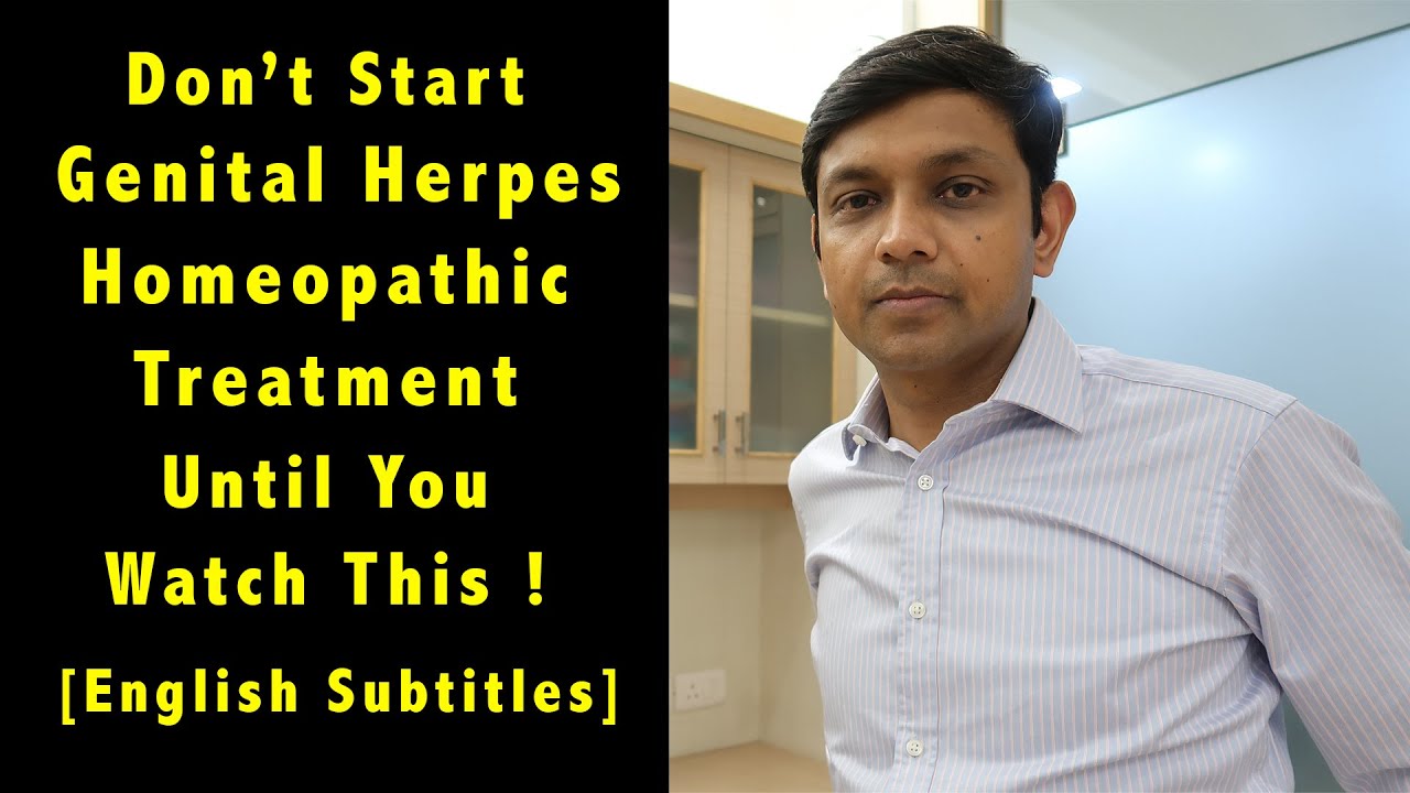 Don't Start Genital Herpes Homeopathic Treatment Until You Watch This!