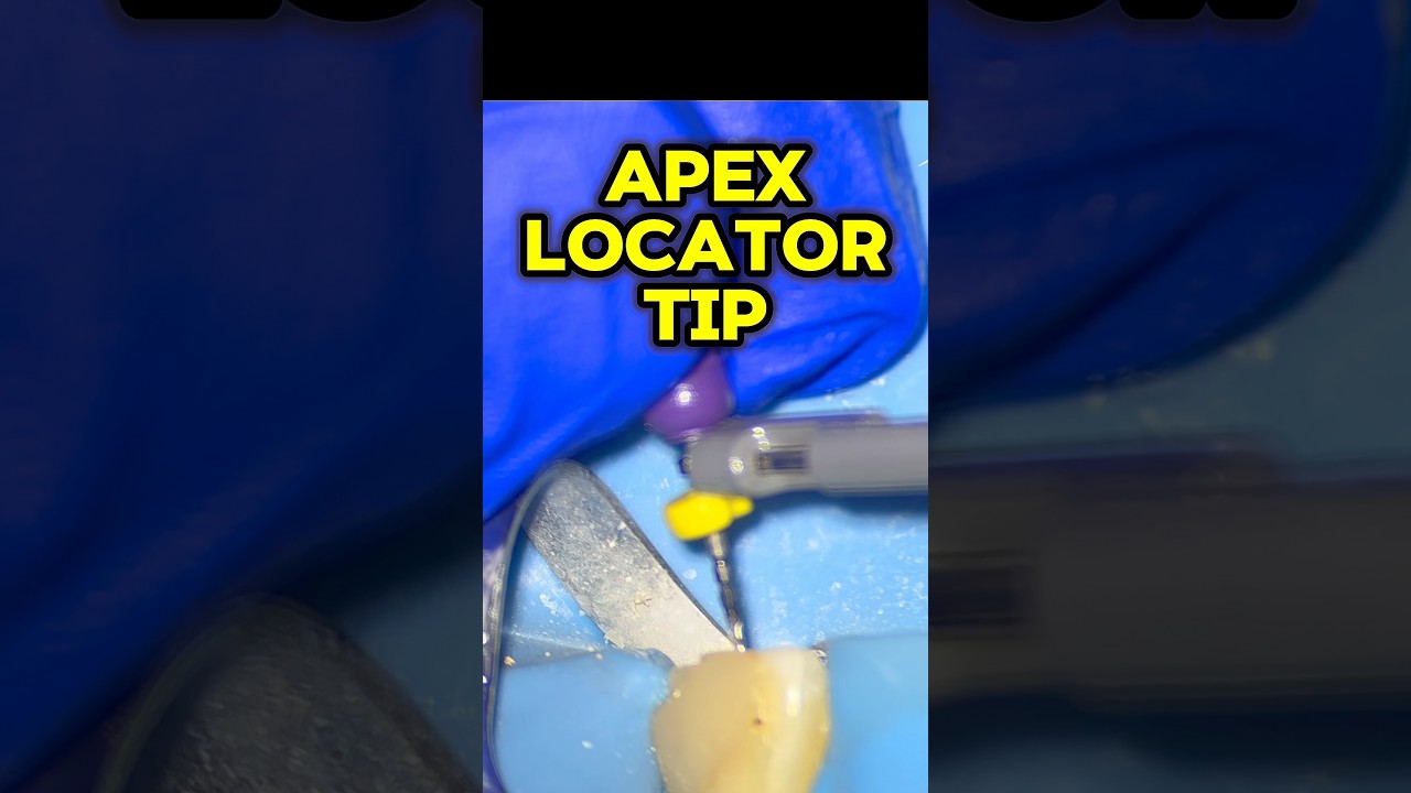 Having APEX locator Problems?