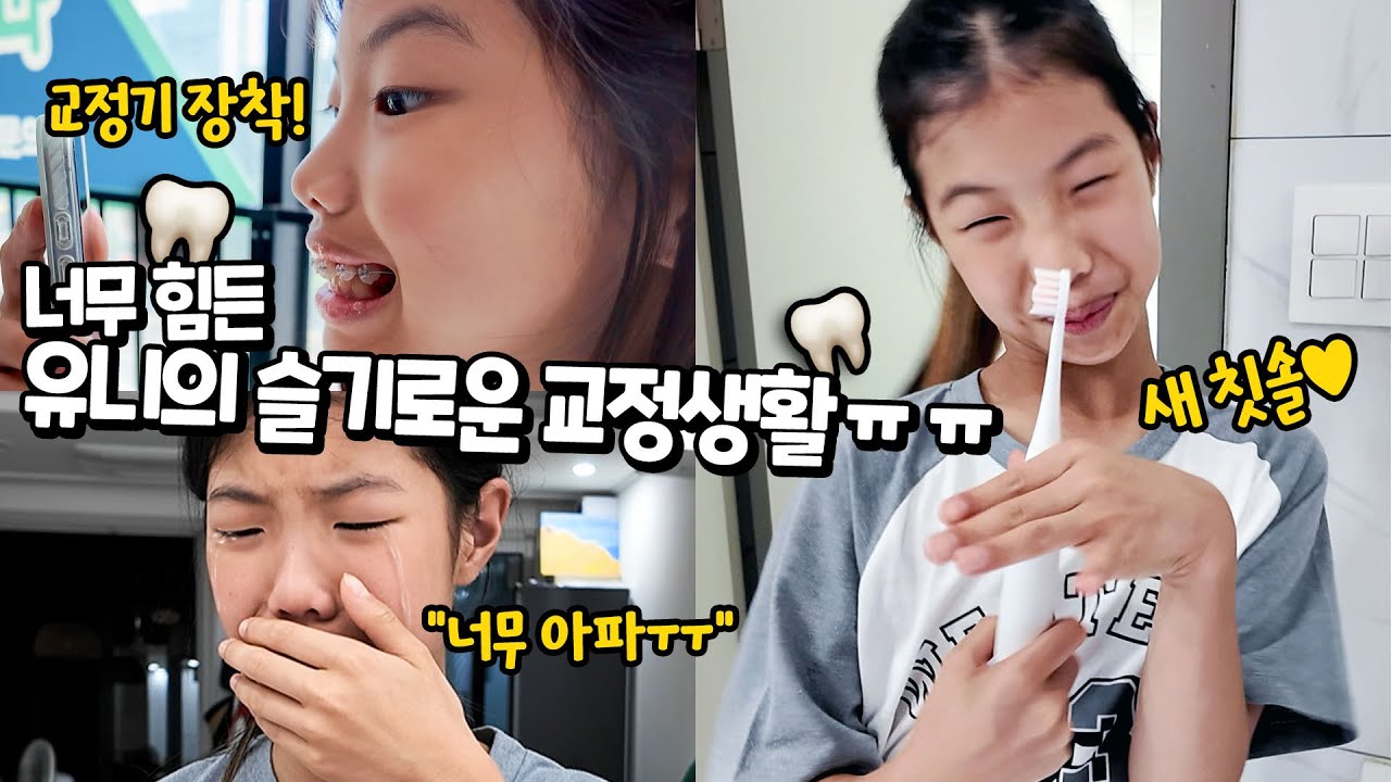 너무 힘든 유니의 슬기로운 교정 생활 ㅠㅠ 교정기 1일 차, 이게 이렇게 아픈 거였어 ?! 유니의 충격 고백 🦷 가족 일상 브이로그 별난가족 (feat Etee 미세전류 전동칫솔)