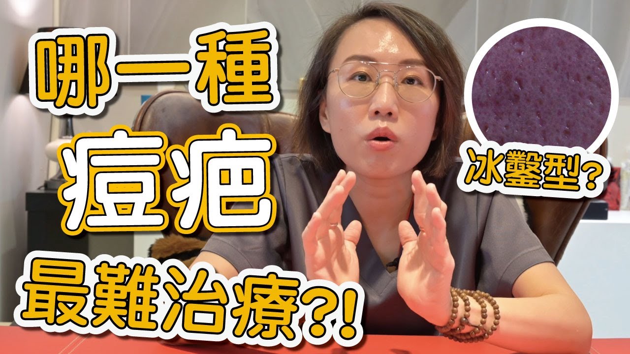 什麼是冰鑿型痘疤？冰鑿型痘疤如何形成？莊盈彥醫師來跟你說如何治療這種嚴重型痘疤！