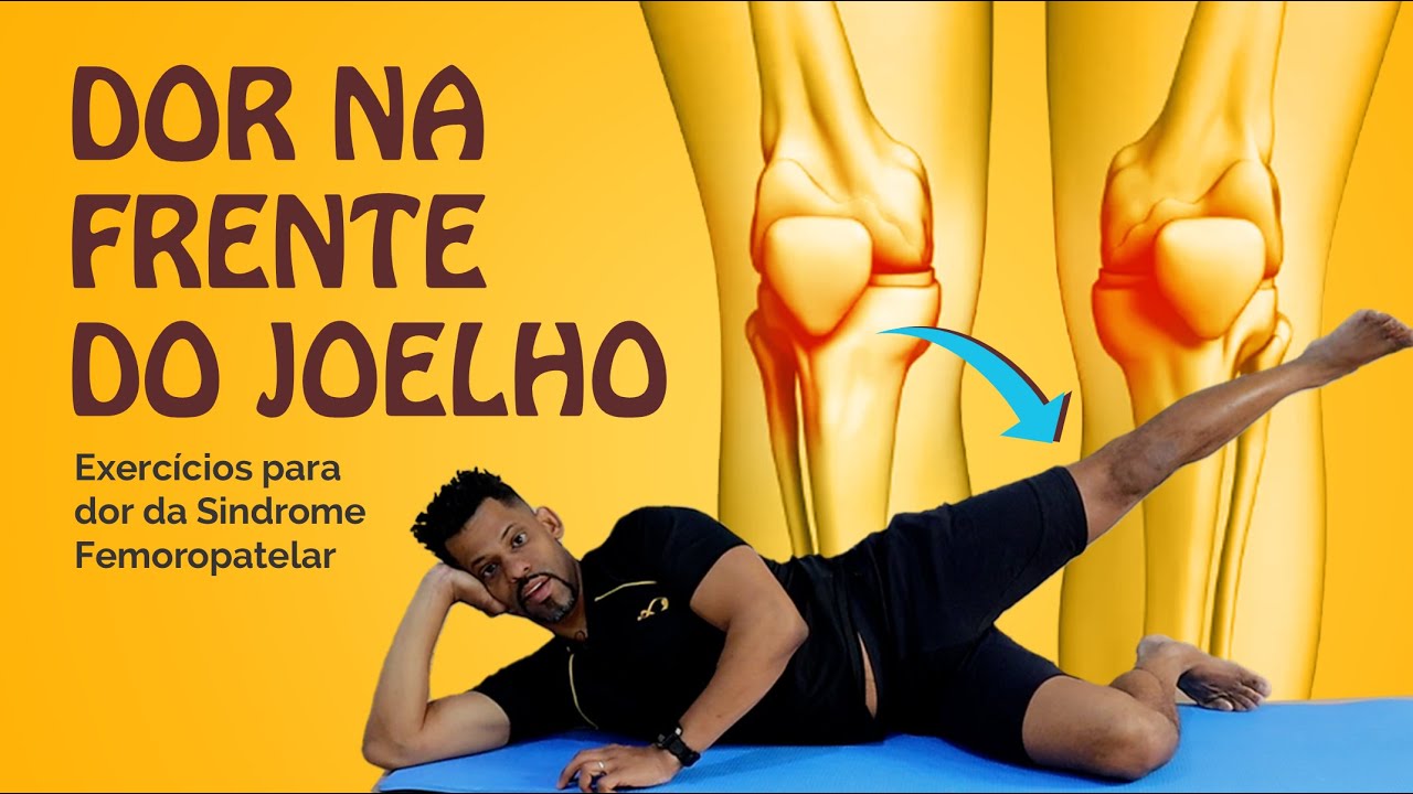 Exercícios essenciais p/ aliviar a dor da Síndrome Femoropatelar - DOR NA FRENTE DO JOELHO