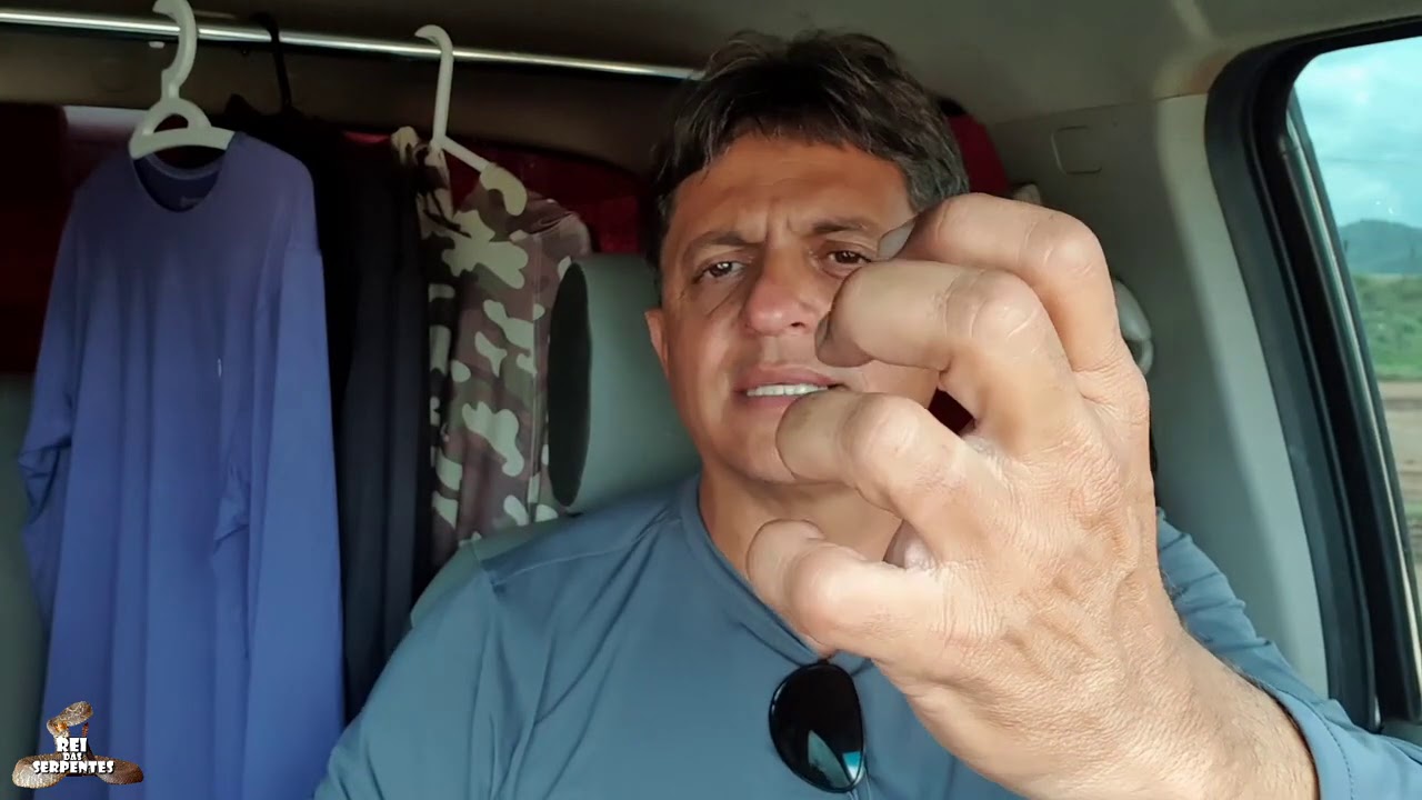 como ficou meu braço depois da picada da cascavel