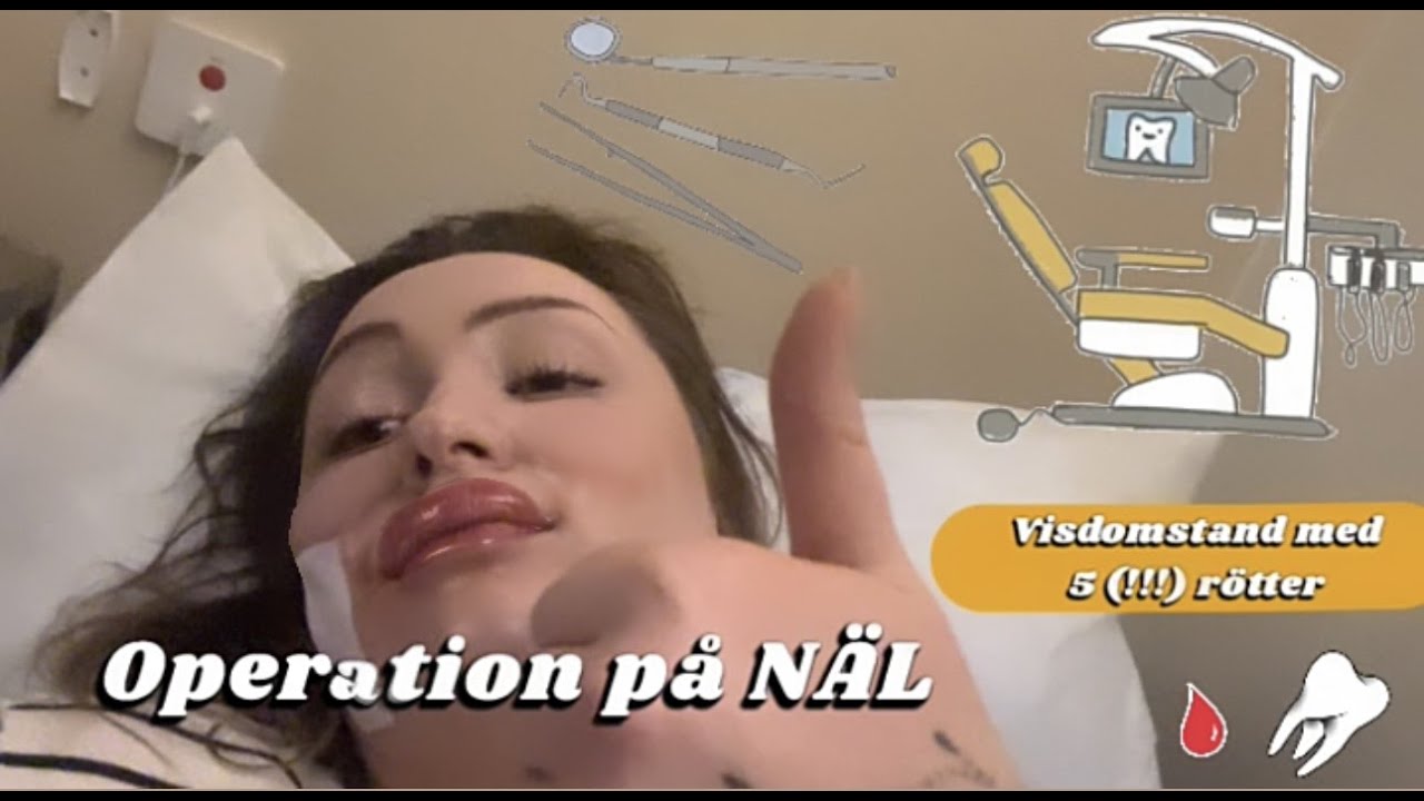 Vlogg#17 - Visdomstandsoperation