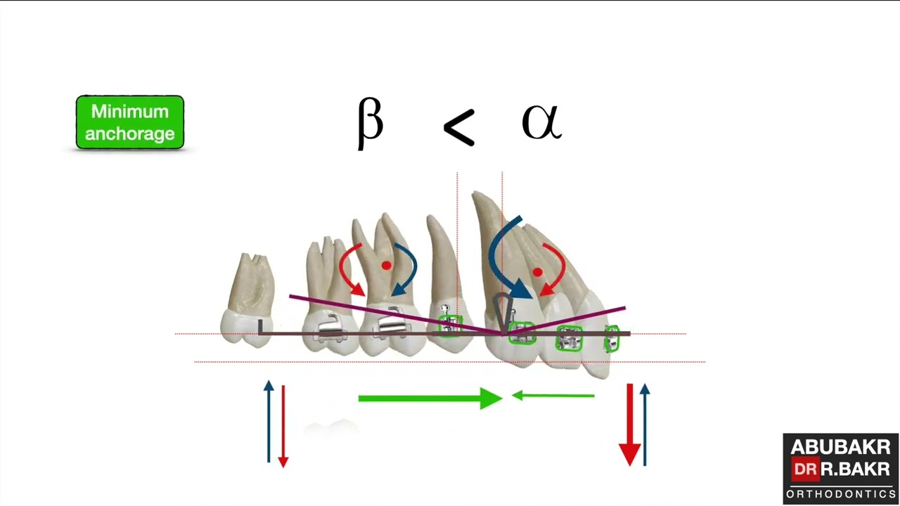 loop position and anchorage control