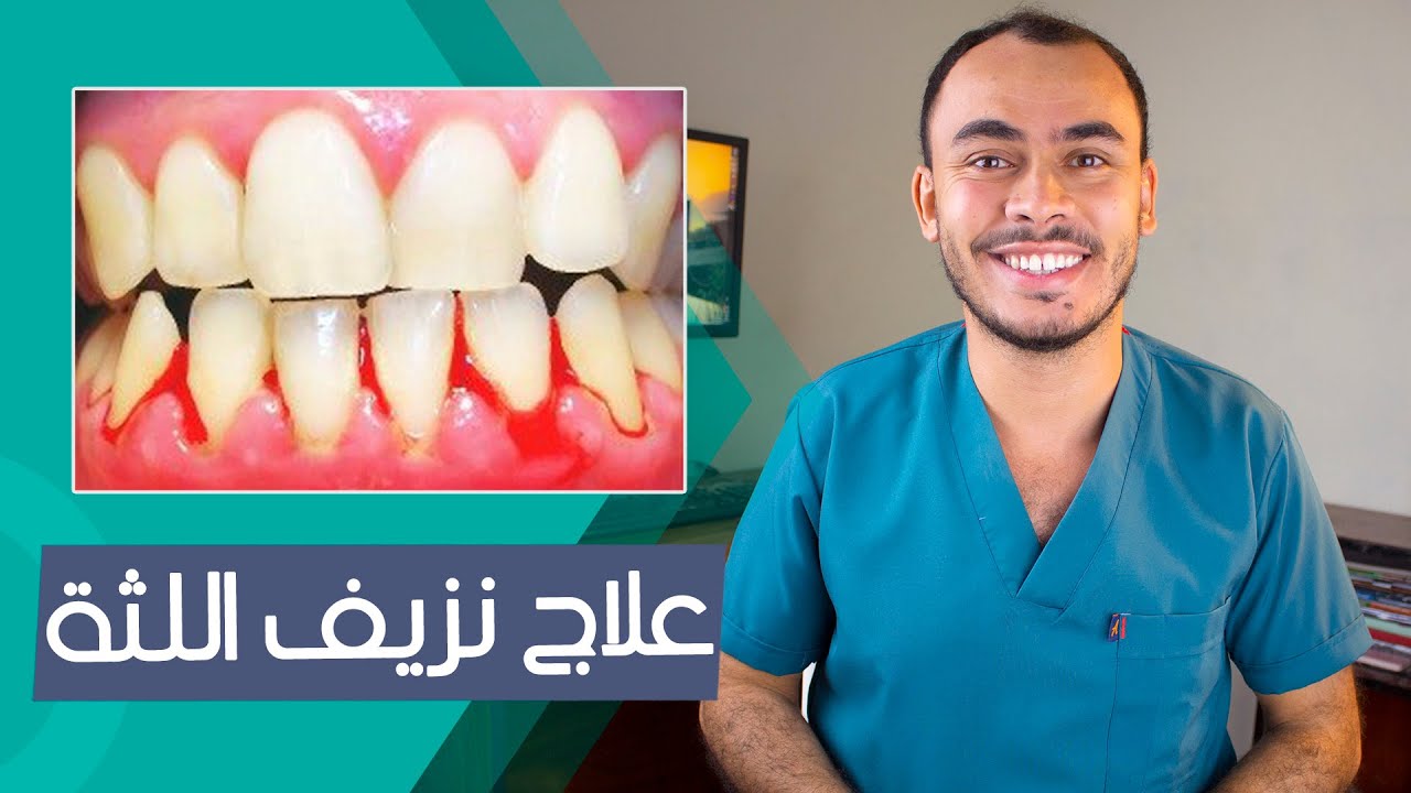 ليه بيحصل ( نزيف اللثة ) مع غسيل الاسنان ؟ التهاب اللثة و جير الاسنان