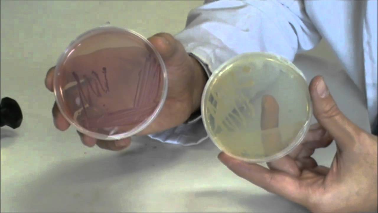 Técnicas básicas de Microbiología: Morfología de Escherichia  coli en  diferentes  medios de cultivo