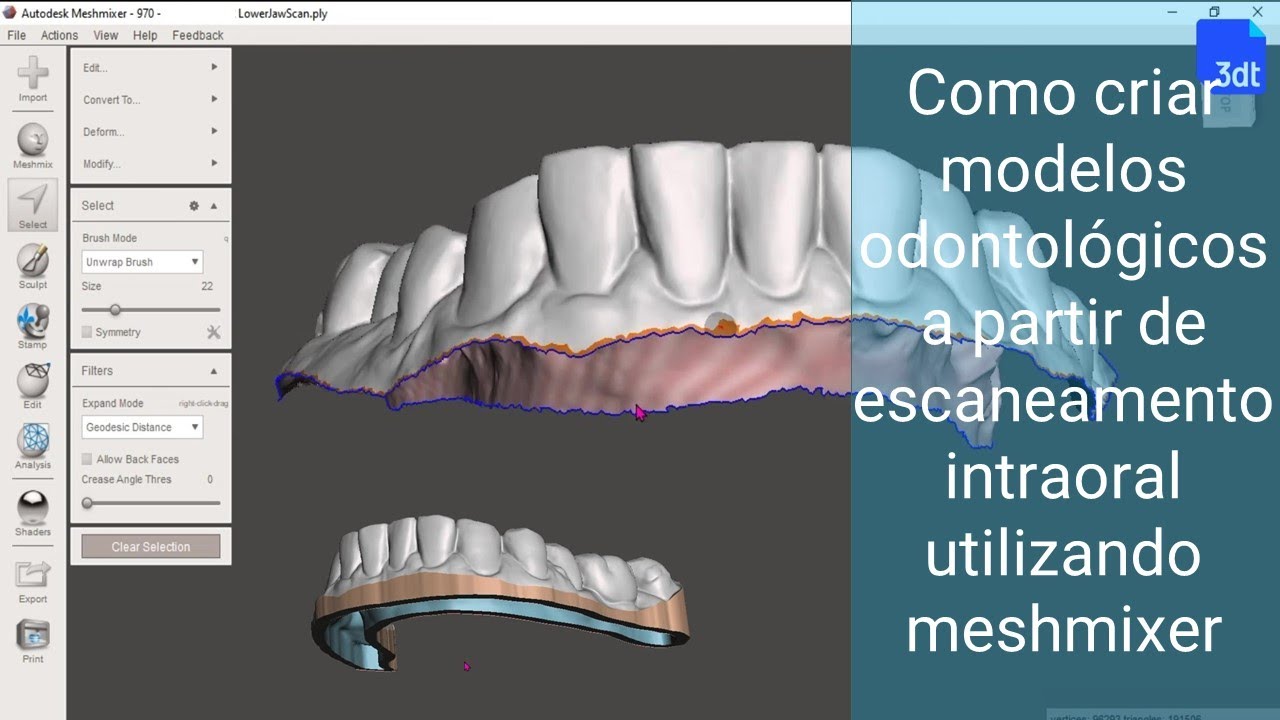 Como criar modelos odontológicos a partir de escaneamento intraoral utilizando meshmixer