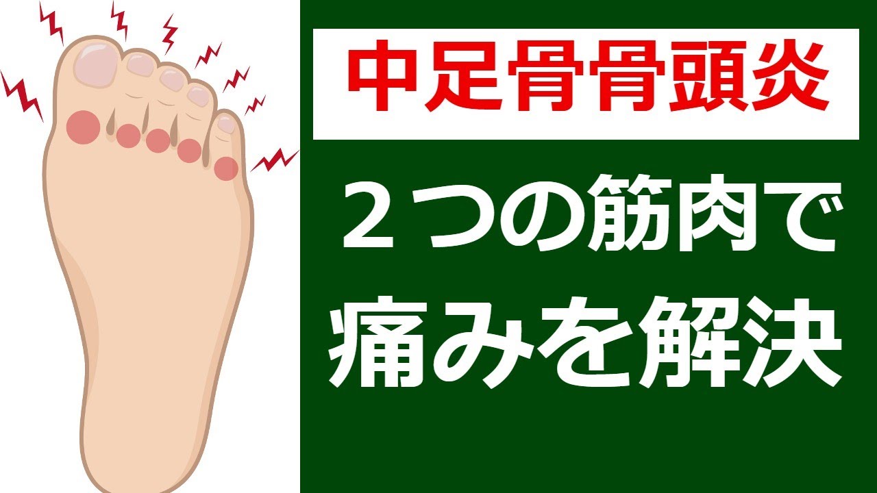 中足骨骨頭痛の治し方。２つの筋肉を緩める事で痛みを改善させる方法｜足の悩み解消チャンネル