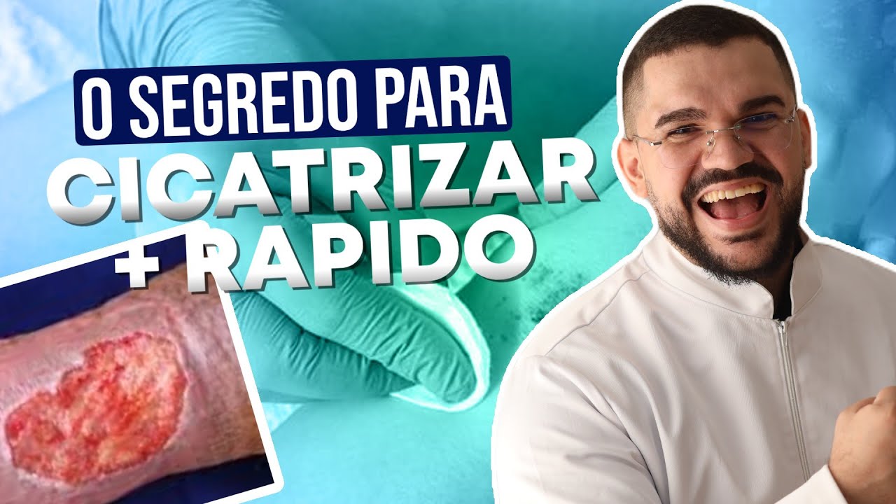 O SEGREDO PARA CICATRIZAR UMA FERIDA MAIS RÁPIDO (APRENDA AGORA)
