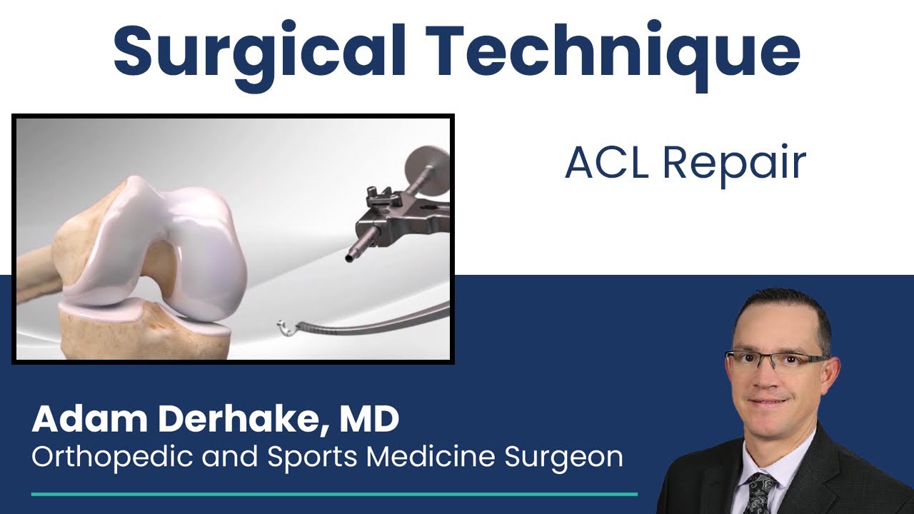 ACL: Surgical Technique