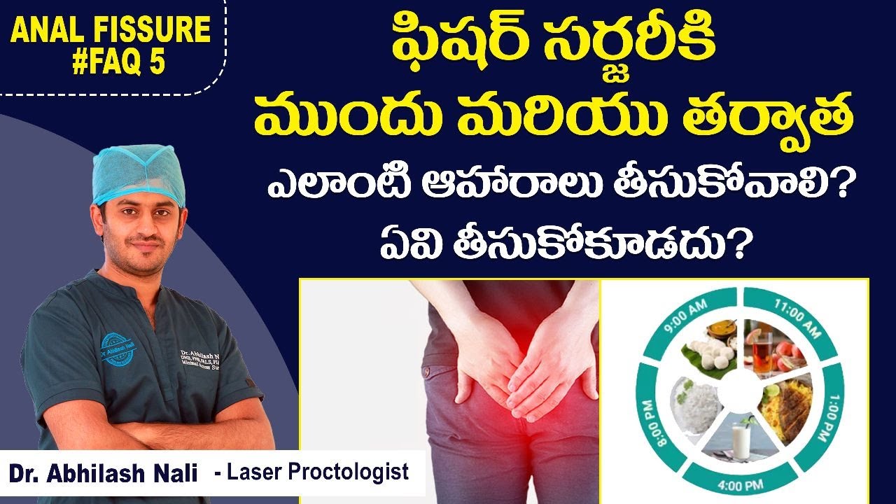 ఫిషర్ సర్జరీకి ముందు తర్వాత డైట్ || Diet Plan Before and After Fissure Surgery || Dr Abhilash Nali