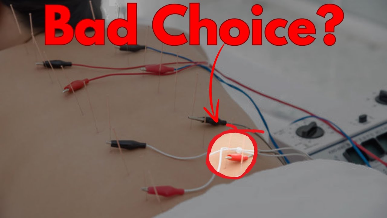 Why E-Stim is Not a Good Choice for Traditional Japanese Acupuncture and Moxa Stimulation