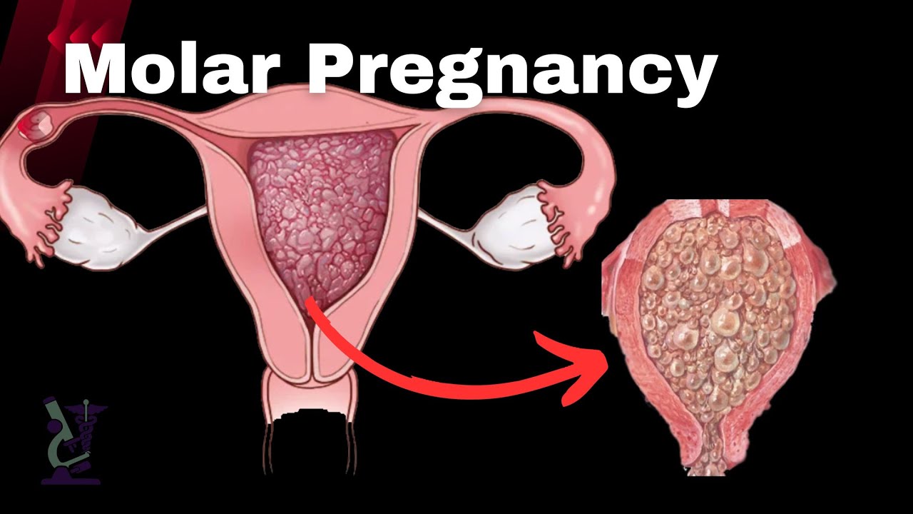 6 More Weird Pregnancies that Actually Happen