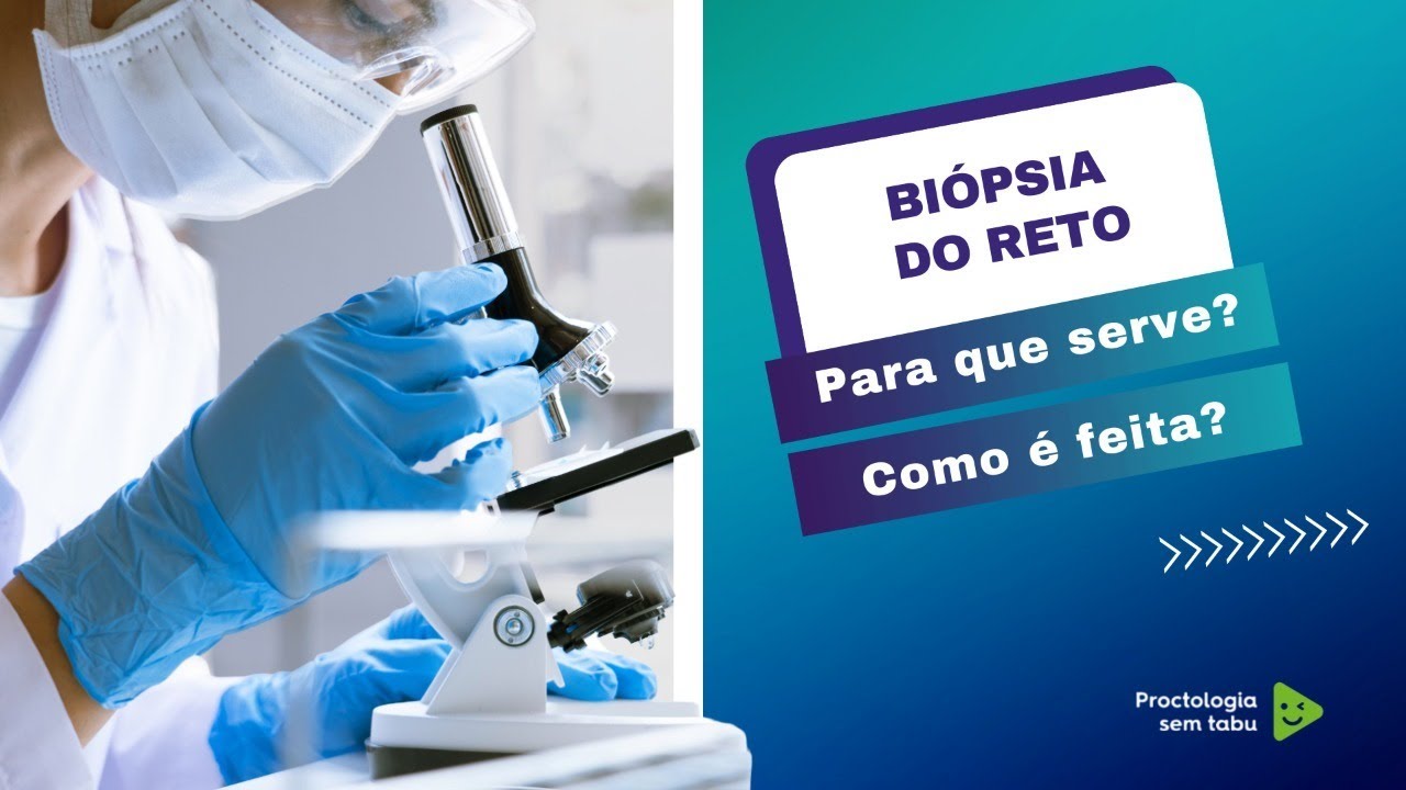 Bi&oacute;psia do reto. 😬Pra que serve? Como &eacute; feita a biopsia retal?