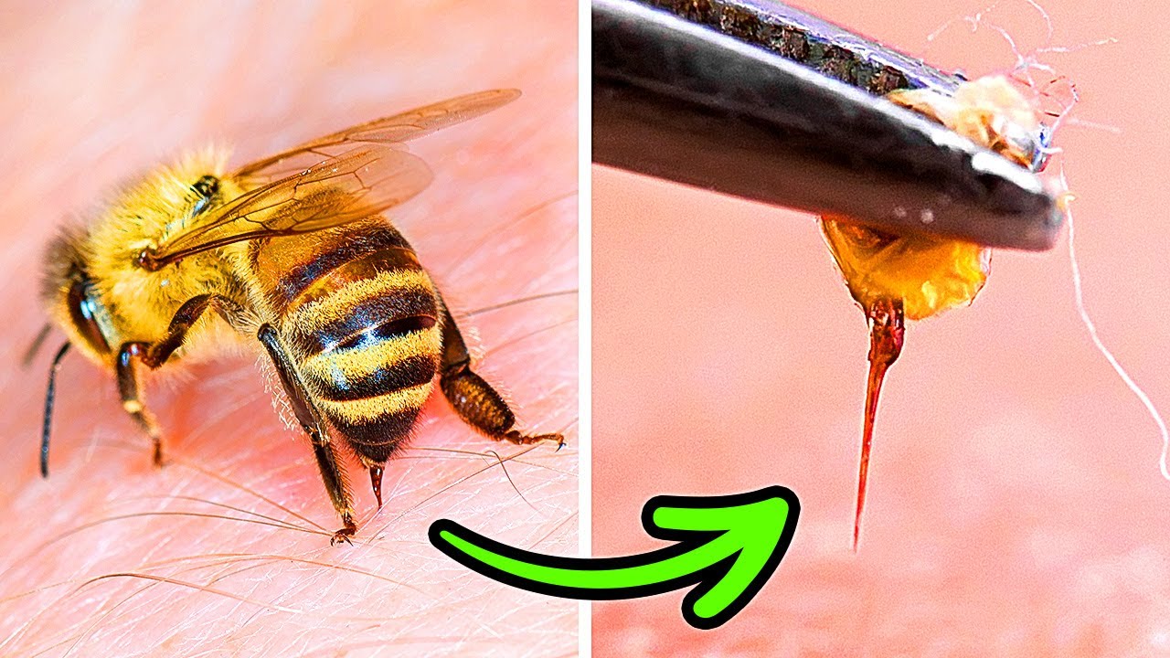 Por Que As Abelhas N&atilde;o Sobrevivem Depois de Picar Voc&ecirc; &ndash; e Outras Curiosidades Sobre Esses Insetos