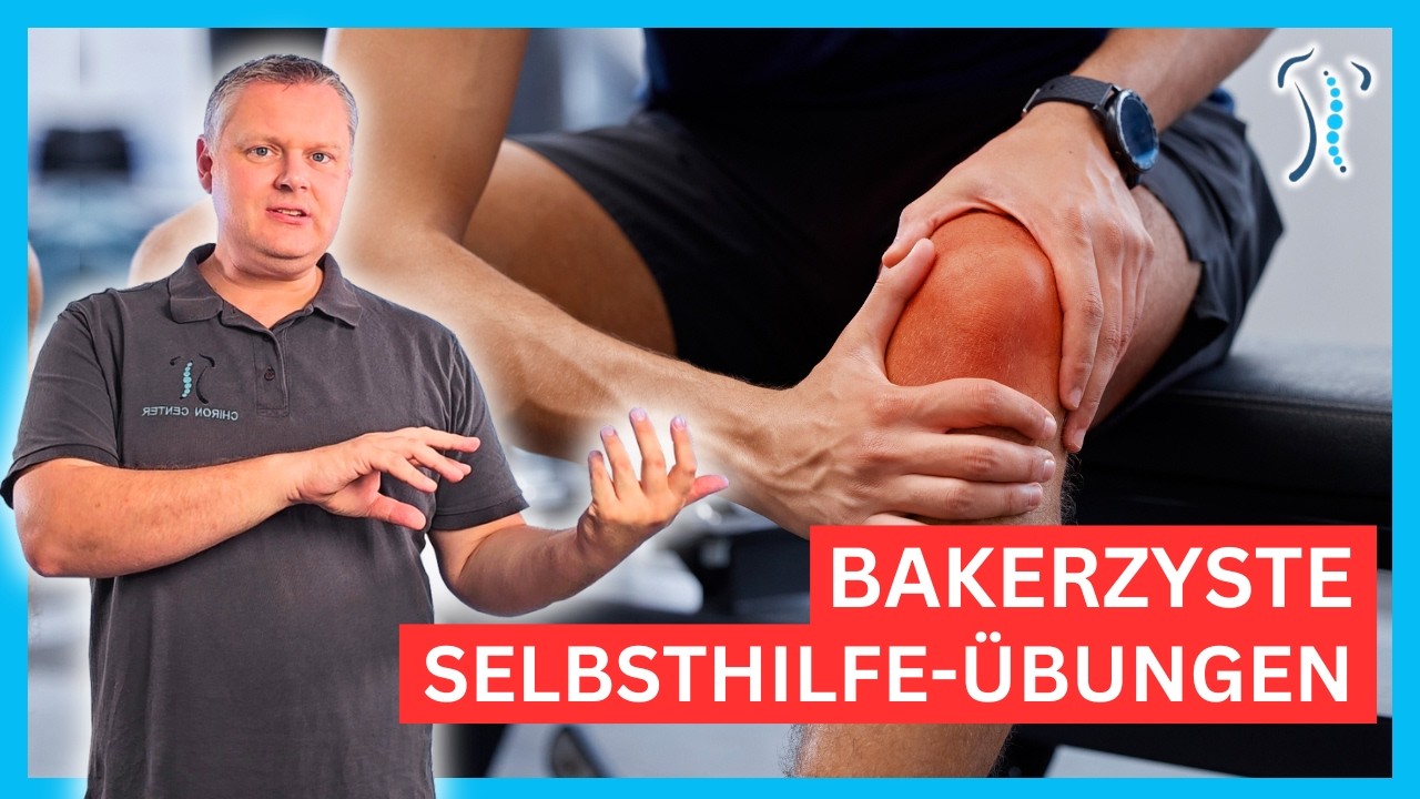 Bakerzyste auch ohne OP behandeln? - 3 Effektive Übungen