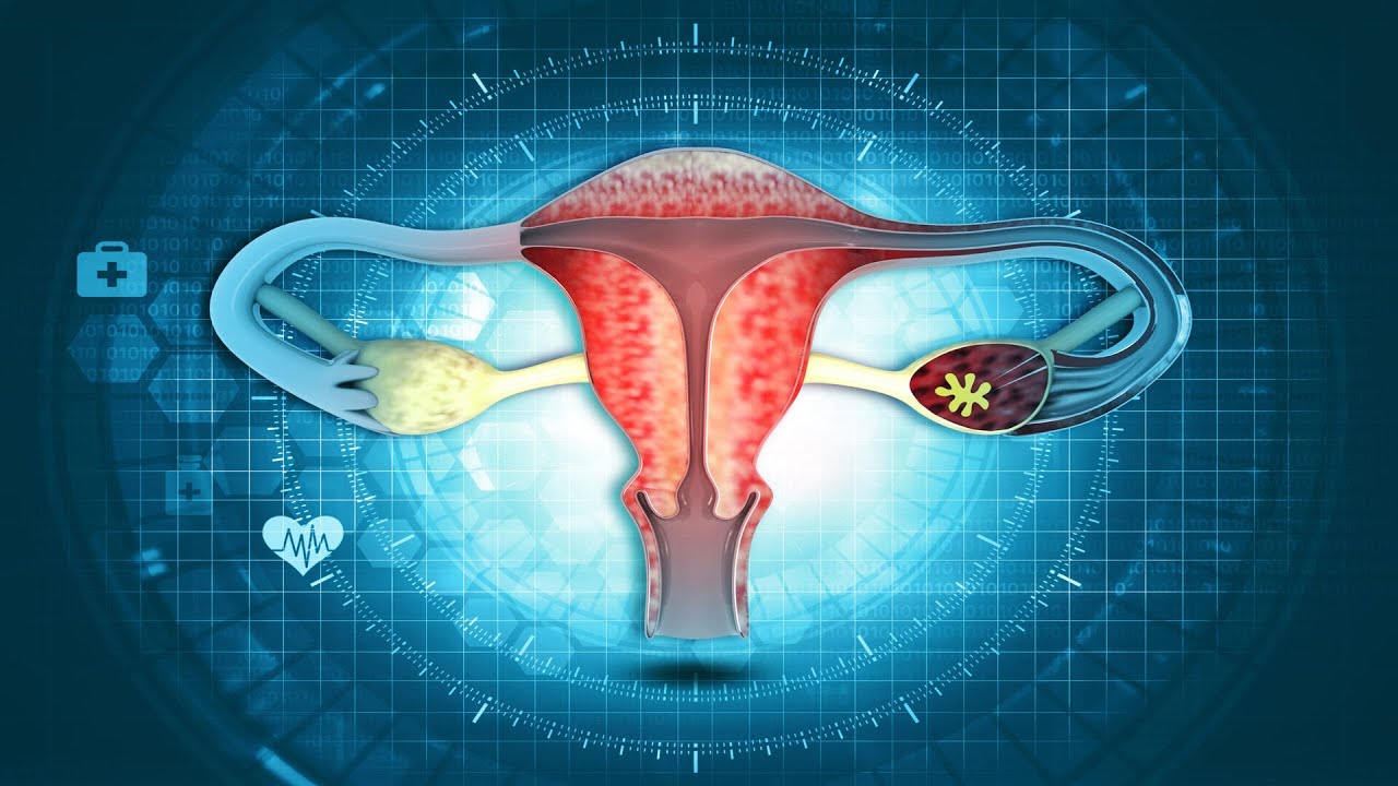 Hablemos de: Cáncer de ovario con la Dra. Loretta Di Giampietro