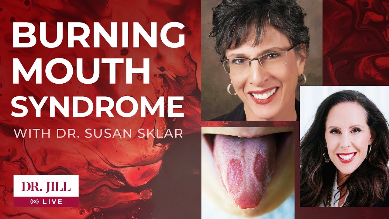 47: Dr.  Jill interviews Dr.  Susan Sklar on Burning Mouth Syndrome
