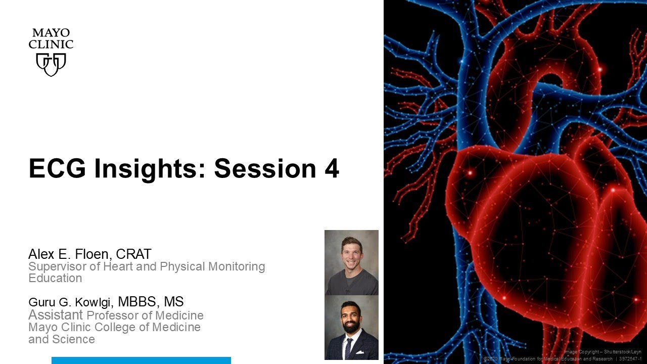 ECG Insights - Session 4