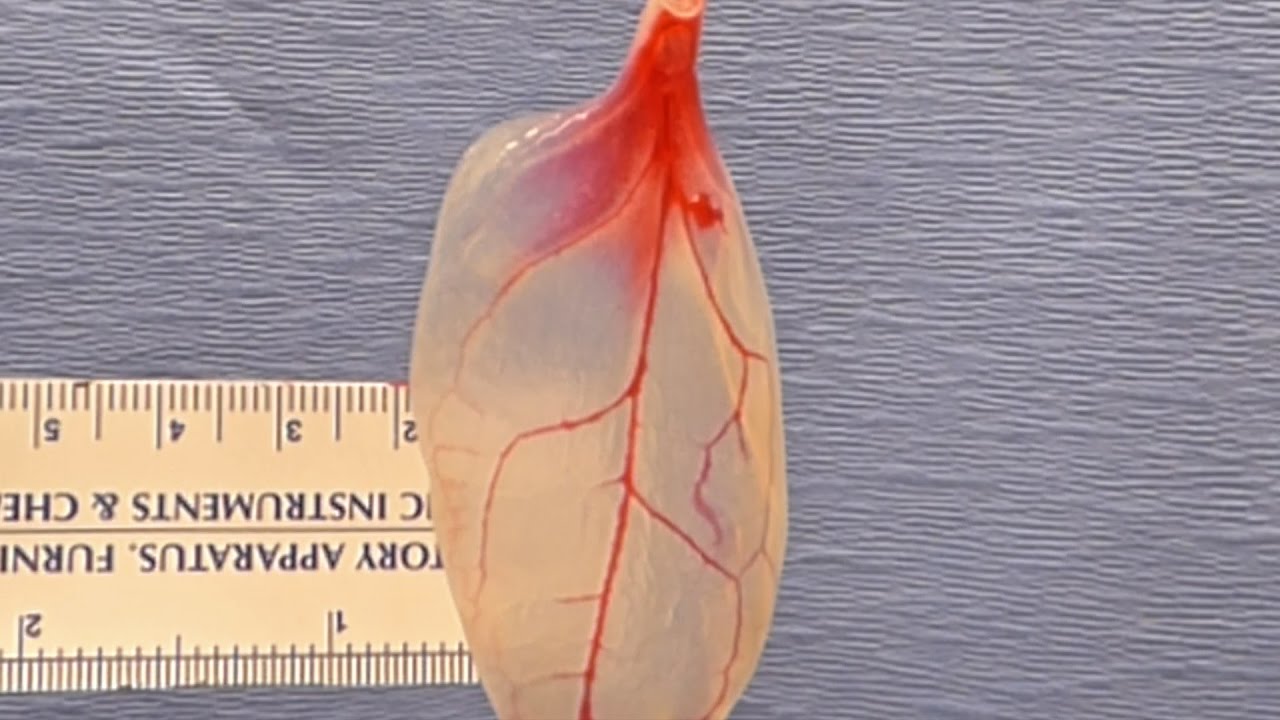 Spinach leaves can carry blood to grow human tissues