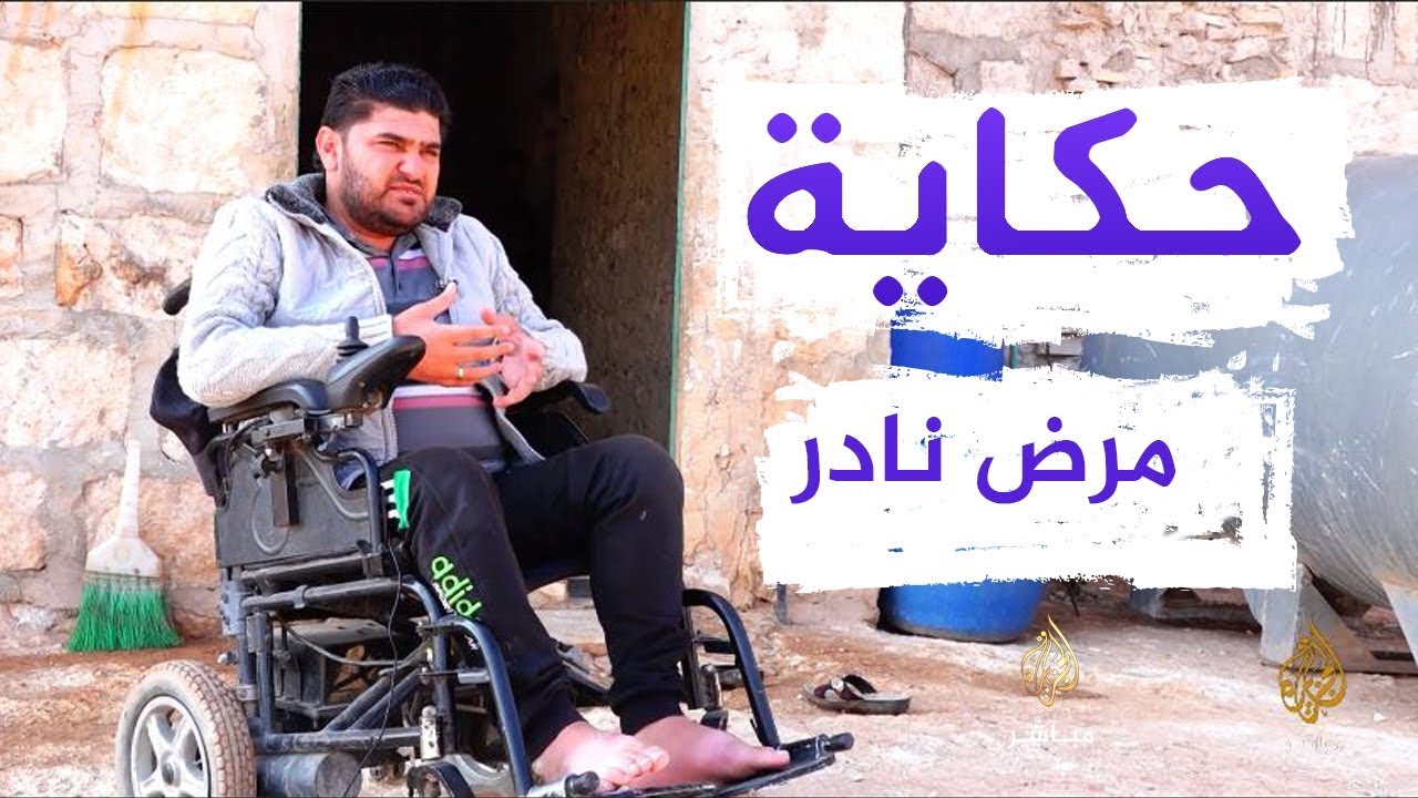 ثلاثة أشقاء سوريين مصابون بمرض نادر يُسمى متلازمة 