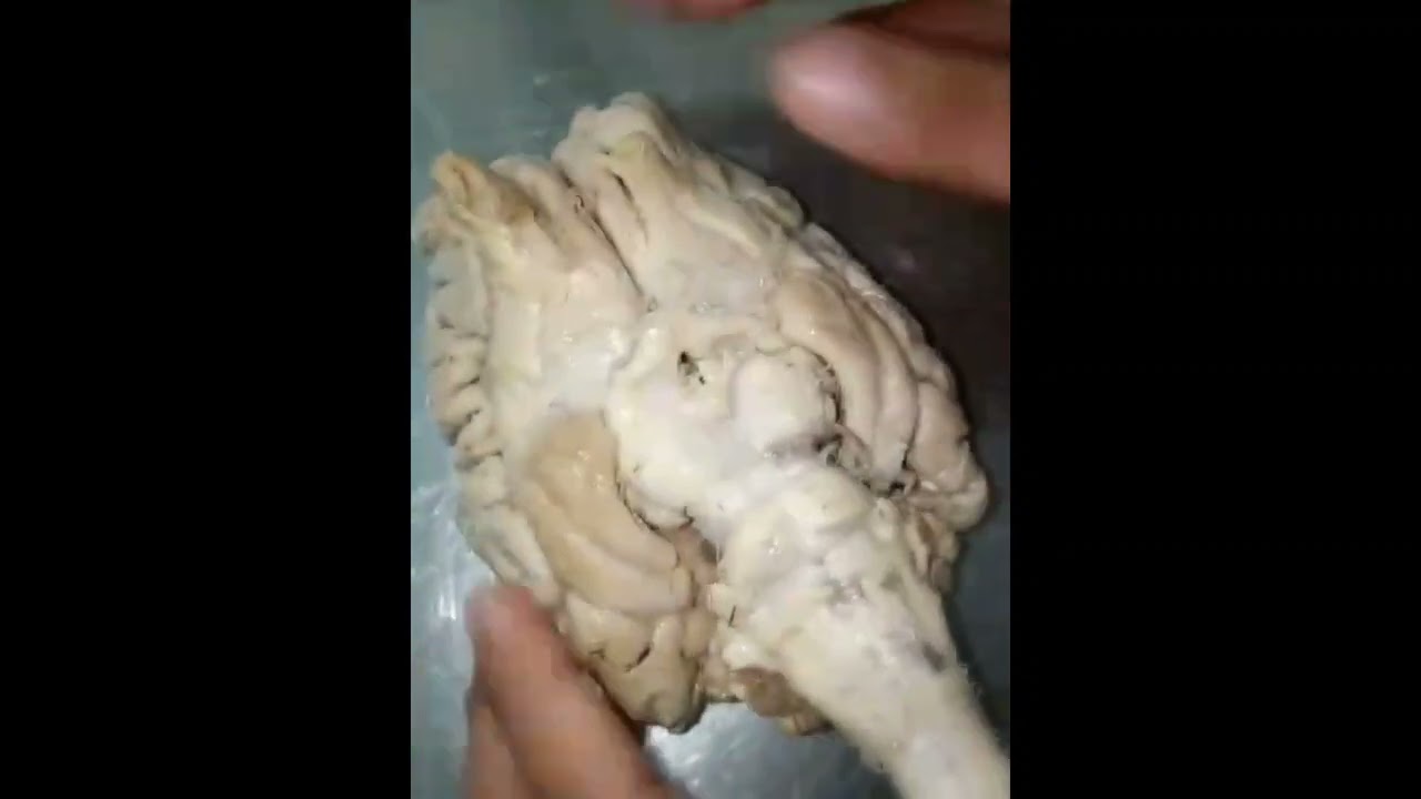 Dorsal and ventral surface of the brain of cattle #anatomy