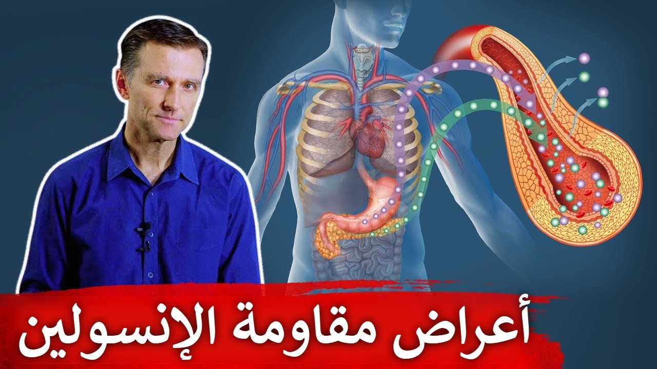 ٢٨ علامة وأعراض تدل على مقاومة الانسولين بالجسم