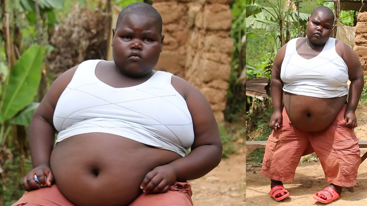 Umwana wimyaka 10 ufite ibiro 100 yatunguye abantu | Ntago abasha kugenda | BITEYE UBWOBA CYANE