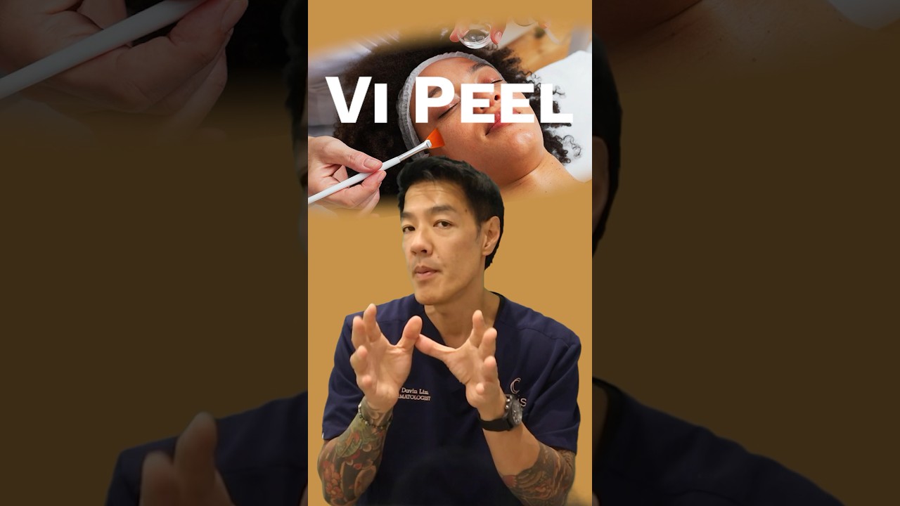 Что такое Vi Peel?
