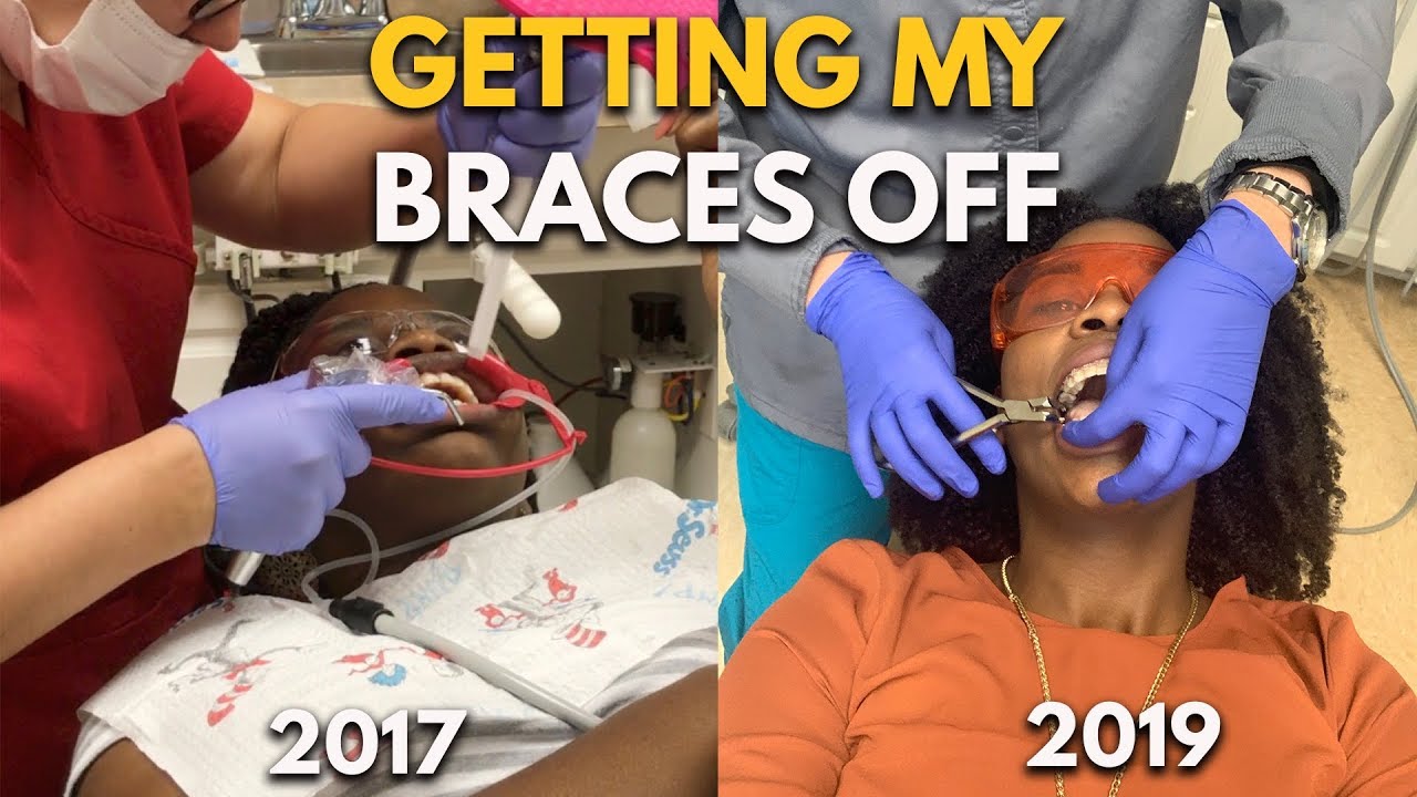 Come With Me To Get My Braces Off!!