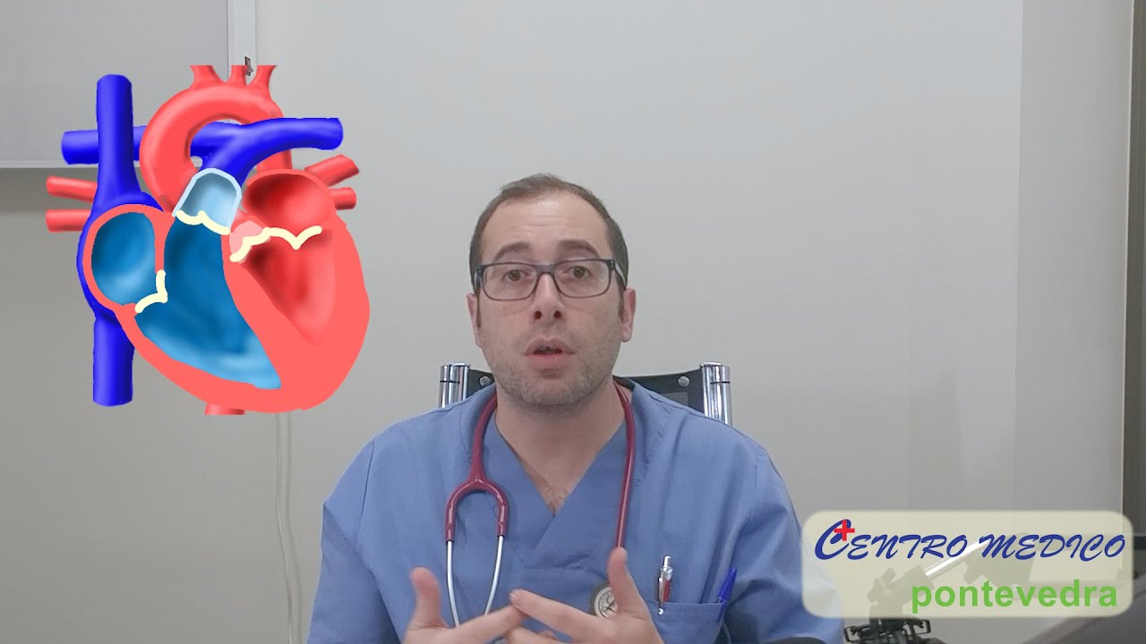 ¿Que es un soplo cardiaco? ¿Por qué los latidos causan dos tonos (