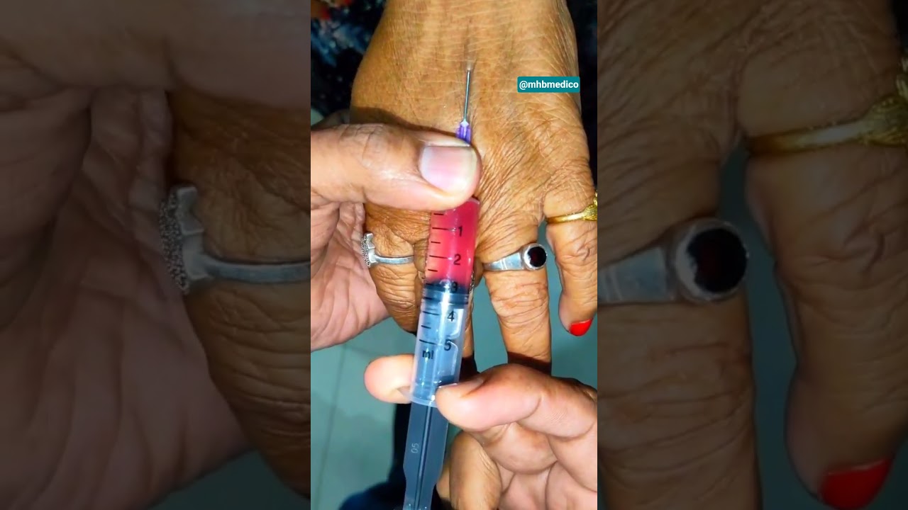 IV Injection Lagane Ka Perfect Tarika 😳 | Step by Step Nursing Skill #Shorts #trending #viral