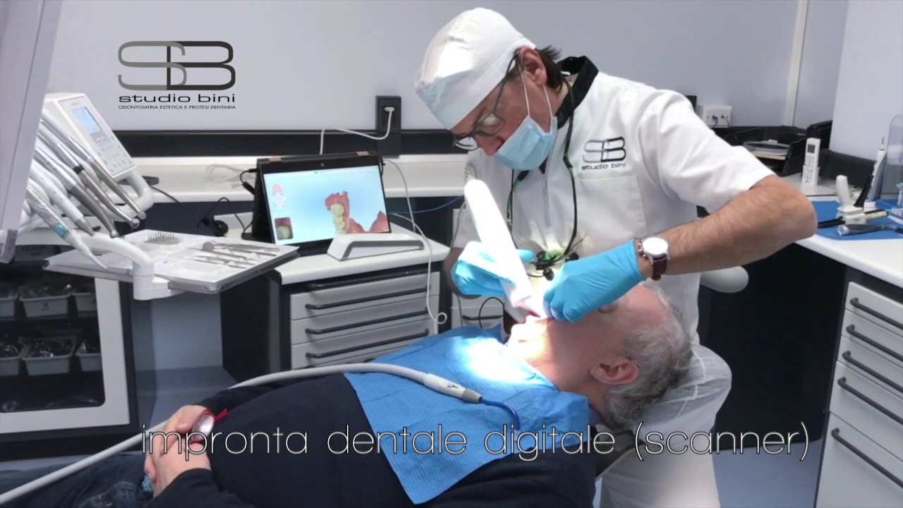 Impronta Digitale Dentale: Perché ?