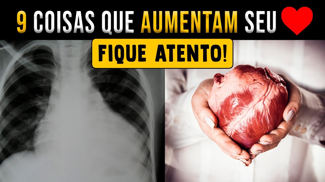 Coração Grande: O que causa? O que é? Quais exames? │ Médico Explica